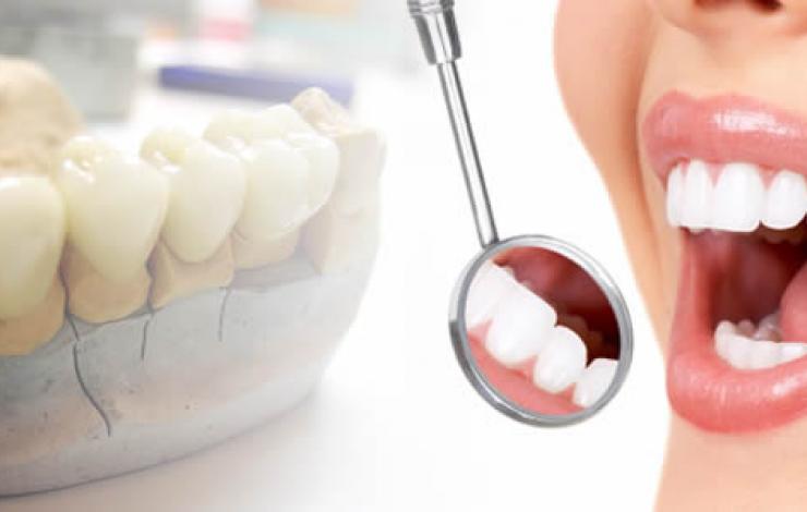 Dantų protezavimas 
